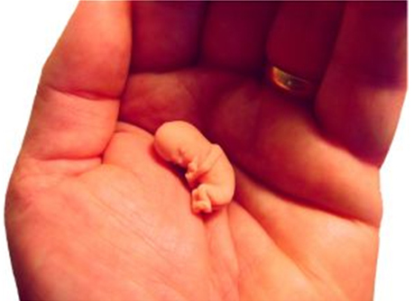 embryo_photo_abortion_help
