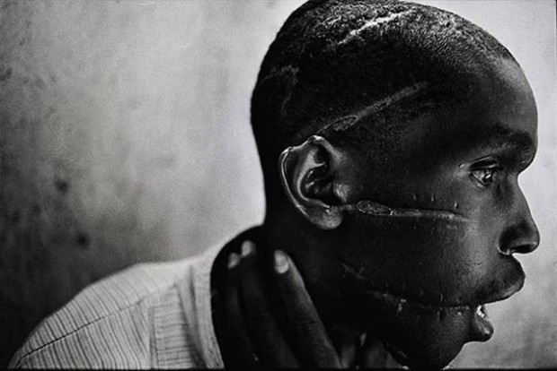 Ο άνθρωπος που επέζησε της γενοκτονίας στη Ρουάντα, από τον James Nachtwey