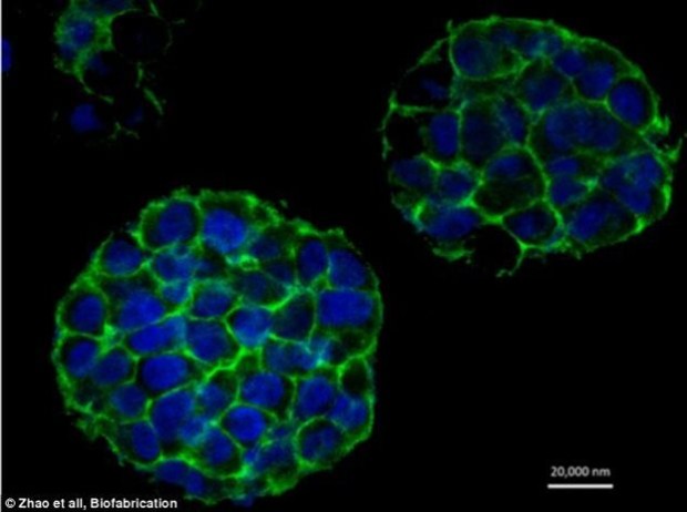 Το τρισδιάστατο μοντέλο ενός καρκινικού όγκου το οποίο δημιουργήθηκε σε εκτυπωτή 3D. Στην εικόνα αυτή φαίνονται τα κύτταρα HeLa επάνω στις δομές που αποτελούνται από ινώδεις πρωτεΐνες και δημιουργούν τις εξωκυττάριες μήτρες των όγκων (Credit:Zhao et al. Biofabrication)