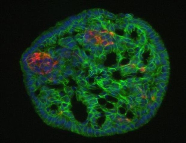 Μαζική παραγωγή των πολύτιμων ινσουλινοπαραγωγων β-κυττάρων επιτυγχάνει η νέα μέθοδος