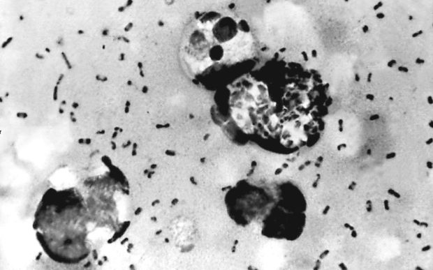 Βακτήρια βουβωνικής πανώλης, παρόμοια με αυτά που προκάλεσαν την επιδημία και τον θάνατο του 25% του πληθυσμού του Λονδίνου κατά τη διετία 1665-1666.