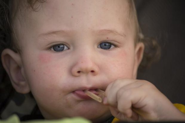 Small child with redness on the skin, suffering from food allergies